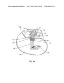 CO-FIRED HERMETICALLY SEALED FEEDTHROUGH WITH ALUMINA SUBSTRATE AND     PLATINUM FILLED VIA FOR AN ACTIVE IMPLANTABLE MEDICAL DEVICE diagram and image