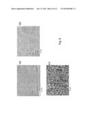 METHOD FOR ENHANCING A METALLIC COATING ON A STEEL STRIP diagram and image