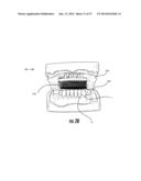 METHODS AND SYSTEMS COMBINING AC ELECTROOSMOSIS WITH DIELECTROPHORESIS TO     ENHANCE DELIVERY OF ACTIVE AGENTS INTO INTRAORAL STRUCTURES diagram and image