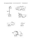 REMOTE MONITORING OF A PATIENT diagram and image