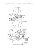 REMOTE MONITORING OF A PATIENT diagram and image