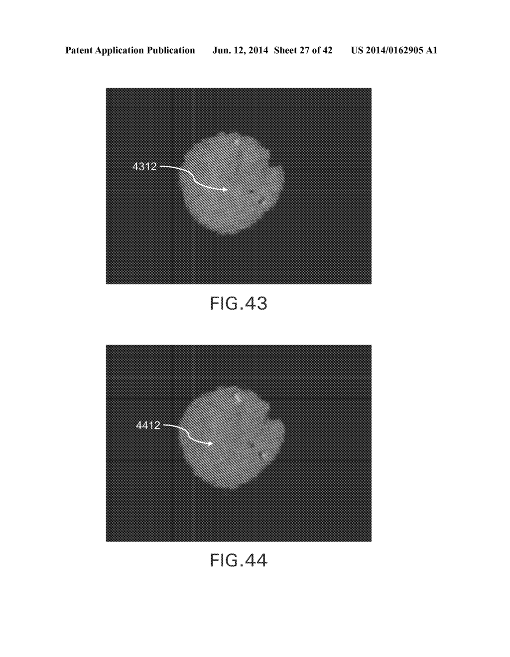 EVAPORATIVE EDGE LITHOGRAPHY OF A LIPOSOMAL DRUG MICROARRAY FOR CELL     MIGRATION ASSAYS - diagram, schematic, and image 28