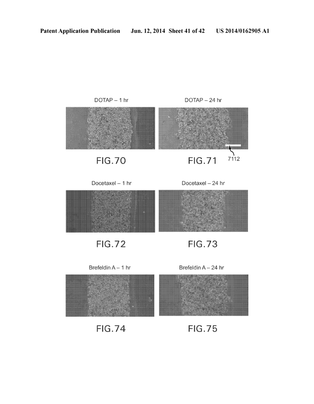 EVAPORATIVE EDGE LITHOGRAPHY OF A LIPOSOMAL DRUG MICROARRAY FOR CELL     MIGRATION ASSAYS - diagram, schematic, and image 42