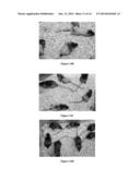 Small Molecule Xanthine Oxidase Inhibitors and Methods of Use diagram and image