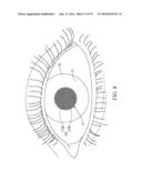 SYSTEM AND METHOD FOR MONITORING CHANGE OF INTRAOCULAR PRESSURE AND     CONTACT LENS FOR SENSING CHANGE OF INTRAOCULAR PRESSURE diagram and image