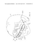 SYSTEM AND METHOD FOR MONITORING CHANGE OF INTRAOCULAR PRESSURE AND     CONTACT LENS FOR SENSING CHANGE OF INTRAOCULAR PRESSURE diagram and image