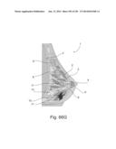 RADIOIMAGING USING LOW DOSE ISOTOPE diagram and image