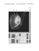 RADIOIMAGING USING LOW DOSE ISOTOPE diagram and image