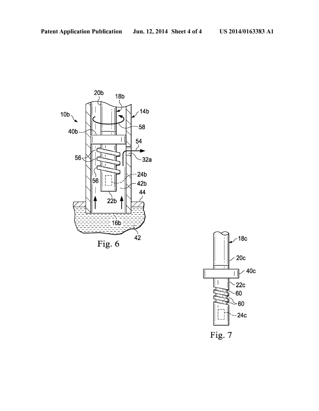 Self-Flushing Intravascular Catheter Apparatus and Associated Methods - diagram, schematic, and image 05