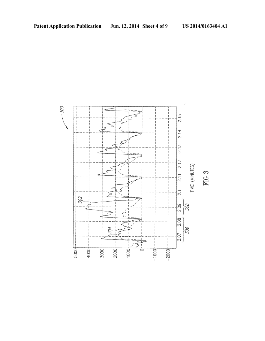 Cerebral Perfusion Monitor - diagram, schematic, and image 05