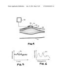 MYOGRAPHY METHOD AND SYSTEM diagram and image