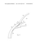 SUPRACHORIODAL DRAINAGE TUBE IN A FLOW CONTROL SYSTEM diagram and image