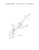 SUPRACHORIODAL DRAINAGE TUBE IN A FLOW CONTROL SYSTEM diagram and image