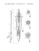 CATHETER HAVING TRANSITIONING SHAFT SEGMENTS diagram and image