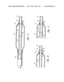 CATHETER HAVING TRANSITIONING SHAFT SEGMENTS diagram and image