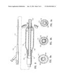 CATHETER HAVING TRANSITIONING SHAFT SEGMENTS diagram and image