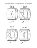 MEDICAL GUIDE ELEMENT WITH DIAMETER TRANSITION diagram and image