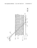 MEDICAL GUIDE ELEMENT WITH DIAMETER TRANSITION diagram and image