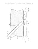 MEDICAL GUIDE ELEMENT WITH DIAMETER TRANSITION diagram and image