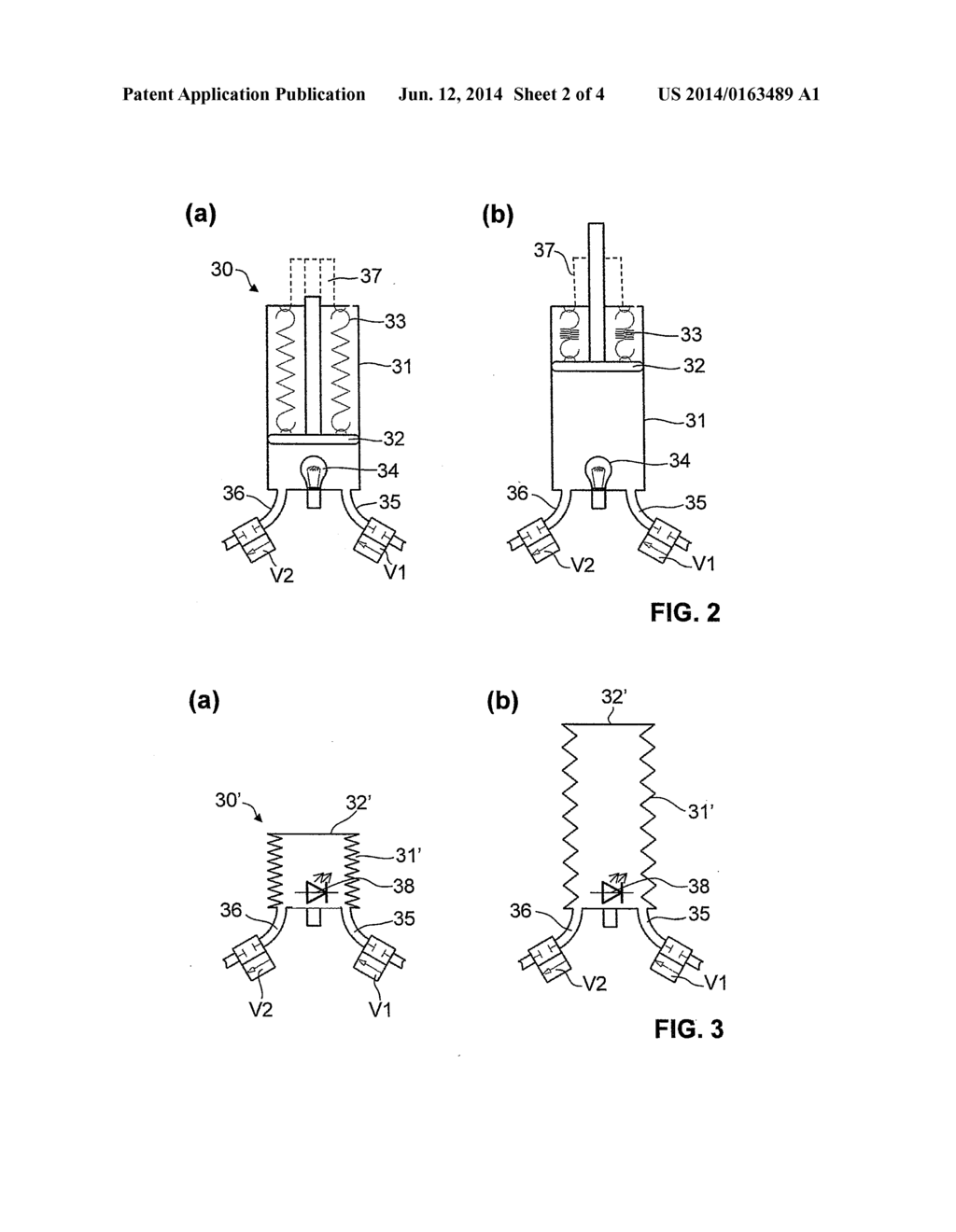 Suction Apparatus with a Flushable Drainage Line - diagram, schematic, and image 03