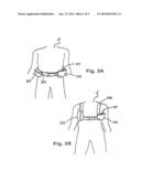 WOUND TREATMENT APPARATUS diagram and image