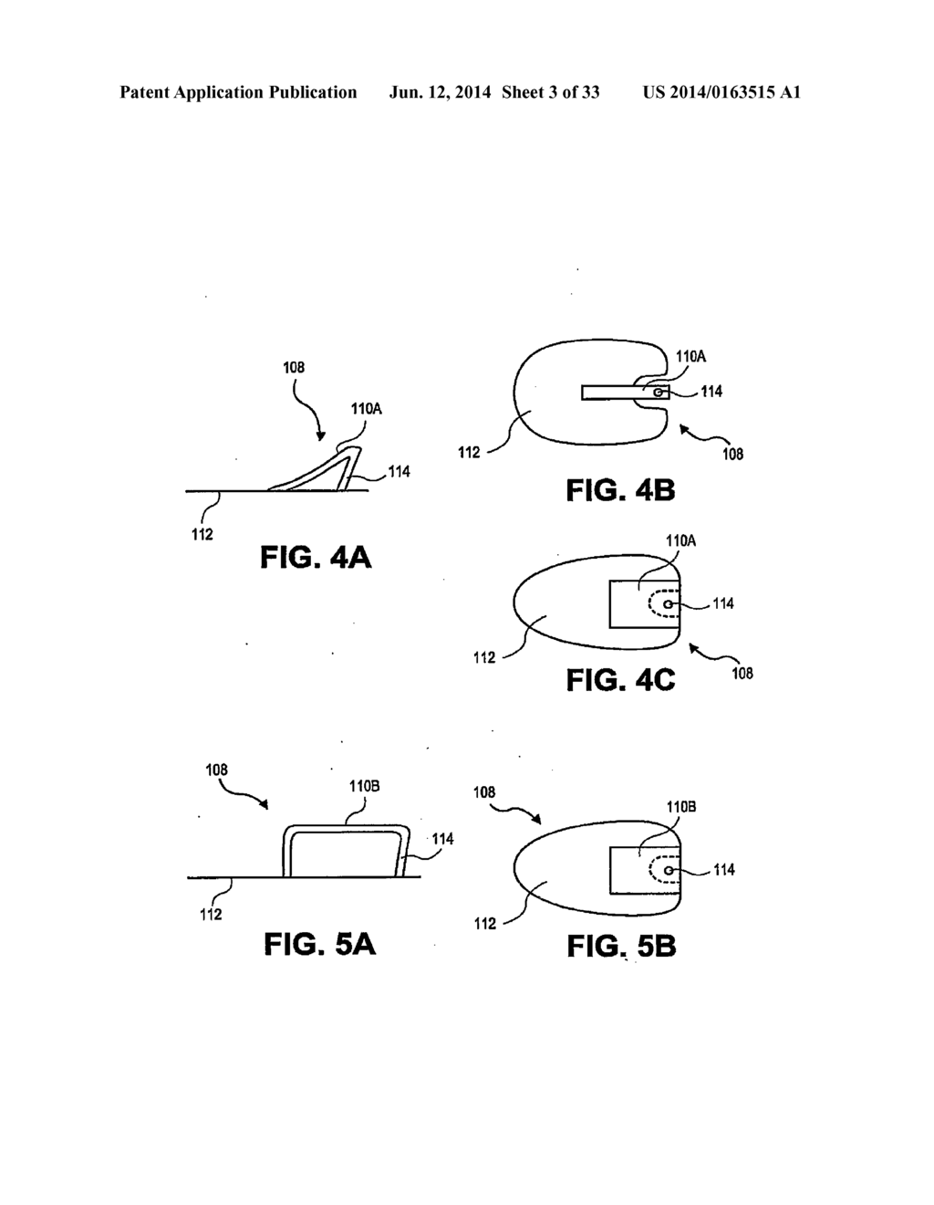 CATHETER SECUREMENT DEVICES - diagram, schematic, and image 04