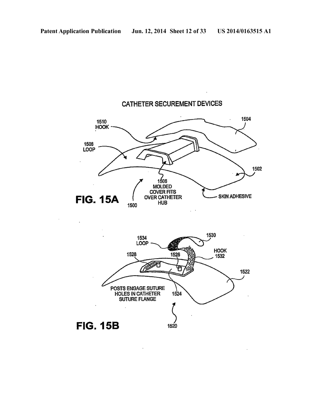 CATHETER SECUREMENT DEVICES - diagram, schematic, and image 13