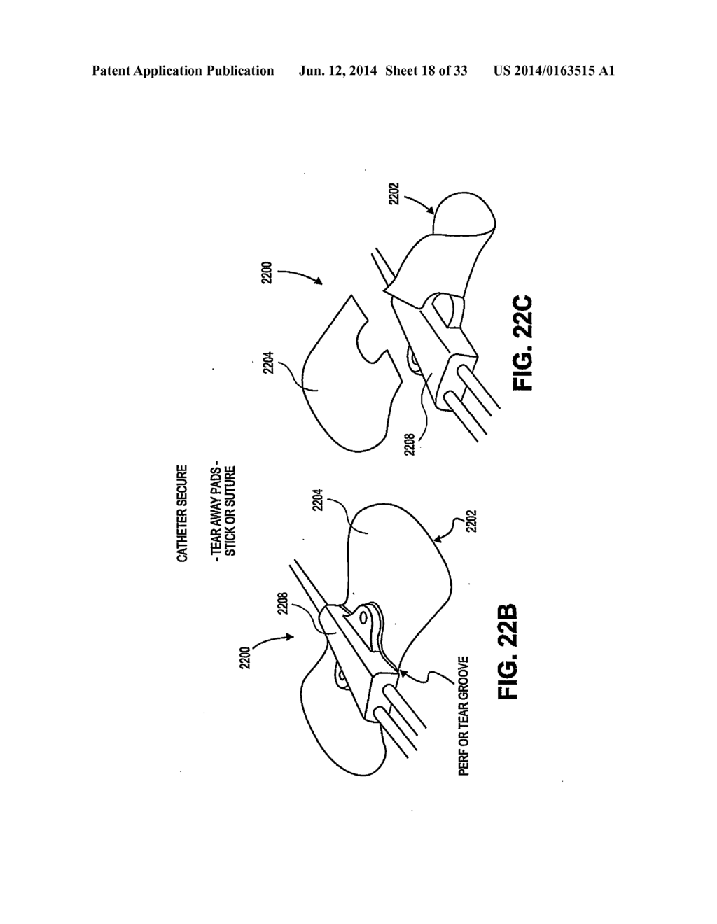 CATHETER SECUREMENT DEVICES - diagram, schematic, and image 19