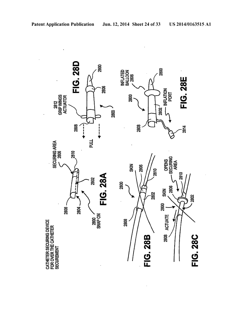 CATHETER SECUREMENT DEVICES - diagram, schematic, and image 25