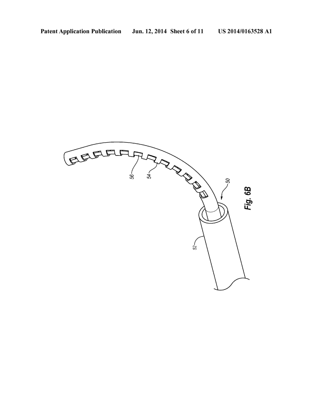 MANEUVERABLE NASOENTERIC FEEDING TUBE - diagram, schematic, and image 07