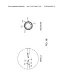 IRREVERSIBLE ELECTROPORATION DEVICE AND METHOD FOR ATTENUATING NEOINTIMAL     FORMATION diagram and image