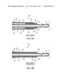 IRREVERSIBLE ELECTROPORATION DEVICE AND METHOD FOR ATTENUATING NEOINTIMAL     FORMATION diagram and image