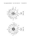 IRREVERSIBLE ELECTROPORATION DEVICE AND METHOD FOR ATTENUATING NEOINTIMAL     FORMATION diagram and image