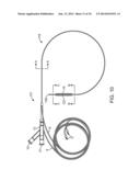 IRREVERSIBLE ELECTROPORATION DEVICE AND METHOD FOR ATTENUATING NEOINTIMAL     FORMATION diagram and image