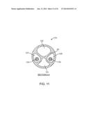 IRREVERSIBLE ELECTROPORATION DEVICE AND METHOD FOR ATTENUATING NEOINTIMAL     FORMATION diagram and image