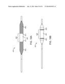 IRREVERSIBLE ELECTROPORATION DEVICE AND METHOD FOR ATTENUATING NEOINTIMAL     FORMATION diagram and image