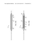 IRREVERSIBLE ELECTROPORATION DEVICE AND METHOD FOR ATTENUATING NEOINTIMAL     FORMATION diagram and image