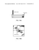 IRREVERSIBLE ELECTROPORATION DEVICE AND METHOD FOR ATTENUATING NEOINTIMAL     FORMATION diagram and image