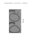 IRREVERSIBLE ELECTROPORATION DEVICE AND METHOD FOR ATTENUATING NEOINTIMAL     FORMATION diagram and image