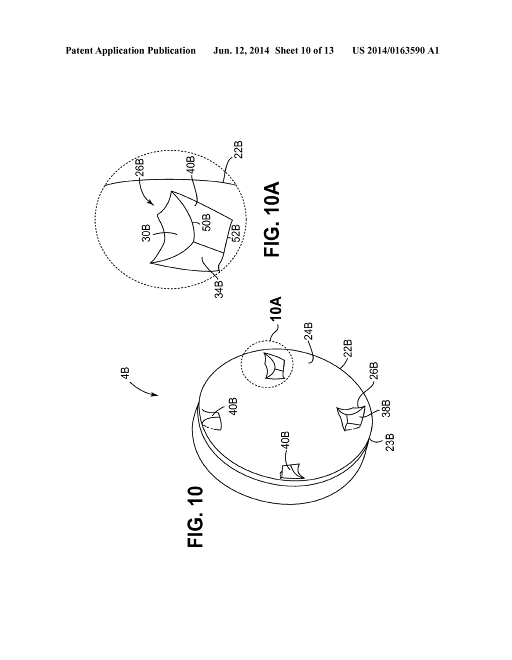 Device for Cutting Tissue - diagram, schematic, and image 11