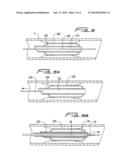 CUTTING WIRE ASSEMBLY FOR USE WITH A CATHETER diagram and image