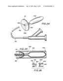 FILTER APPARATUS FOR OSTIUM OF LEFT ATRIAL APPENDAGE diagram and image