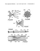 FILTER APPARATUS FOR OSTIUM OF LEFT ATRIAL APPENDAGE diagram and image