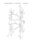 Flexible Anchors For Tissue Fixation diagram and image