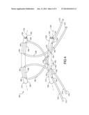 Flexible Anchors For Tissue Fixation diagram and image