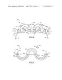 Flexible Anchors For Tissue Fixation diagram and image