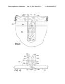 Flexible Anchors For Tissue Fixation diagram and image