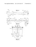 Flexible Anchors For Tissue Fixation diagram and image