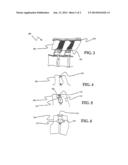 Interspinous Internal Fixation/Distraction Device diagram and image