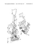 TARGETING GUIDE WITH A RADIOPAQUE MARKER TO FACILITATE POSITIONING A BONE     PLATE ON BONE diagram and image